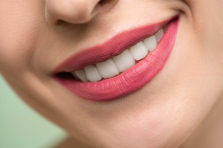 Boosting Your Confidence with Color Correct Teeth Whitening